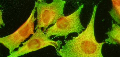 stem cells