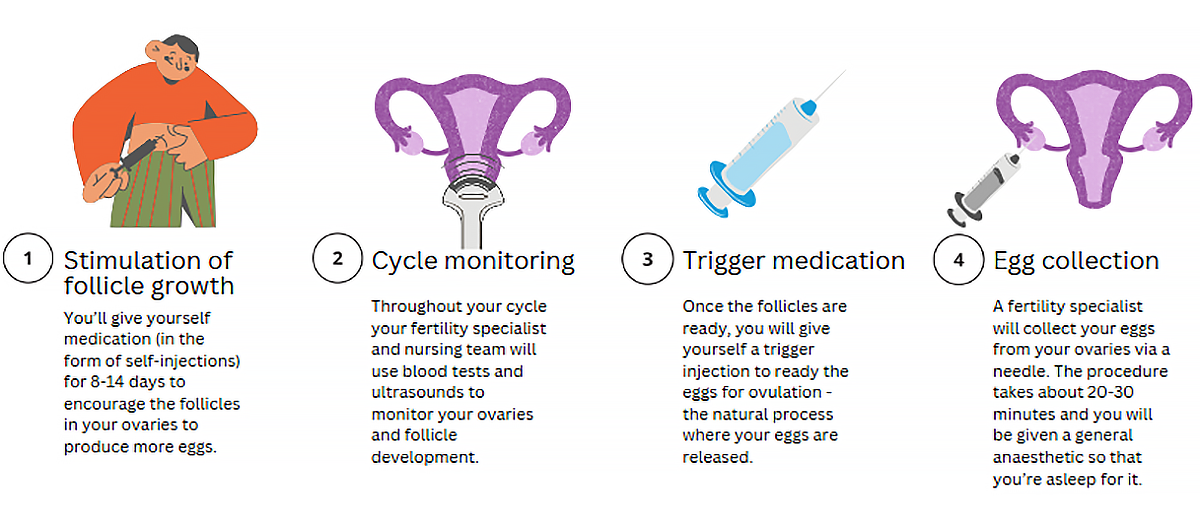 1.Stimulation of follicle growth You’ll give yourself medication (in the form of self-injections) for 8-14 days to encourage the follicles in your ovaries to produce more eggs. 2.Cycle monitoring Throughout your cycle your fertility specialist and nursing team will use blood tests and ultrasounds to monitor your ovaries and follicle development. 3.Trigger medication Once the follicles are ready, you will give yourself a trigger injection to ready the eggs for ovulation - the natural process where your eggs are released. 4.Egg collection A fertility specialist will collect your eggs from your ovaries via a needle. The procedure takes about 20-30 minutes and you will be given a general anaesthetic so that you’re asleep for it.