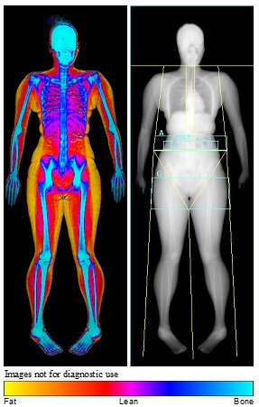 Body composition