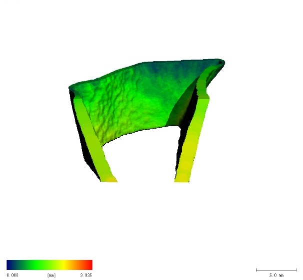 Cortical density