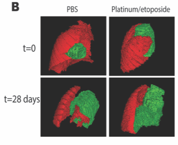 IMAGE B: 3D reconstructions of lung (red) and tumour (green) in mice treated with vehicle (PBS) or with standard of care chemotherapy (Platinum/etoposide).