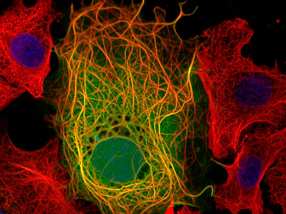 The figure shows a high resolution confocal image of viral protein targeting of microtubules The figure shows a high resolution confocal image of viral protein targeting of microtubules