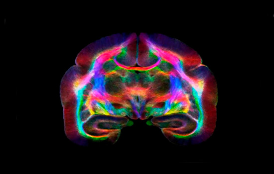 Van-Cleef-Roet-neuroscience-brain-v2.jpg