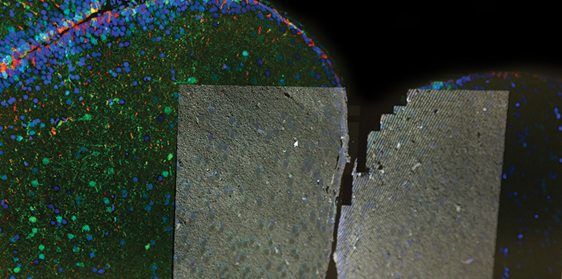 Cryo Electron Microscopy
