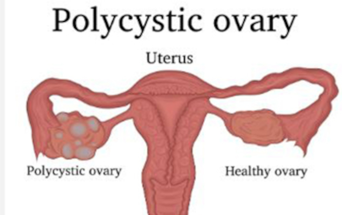 Diagram of a uterus