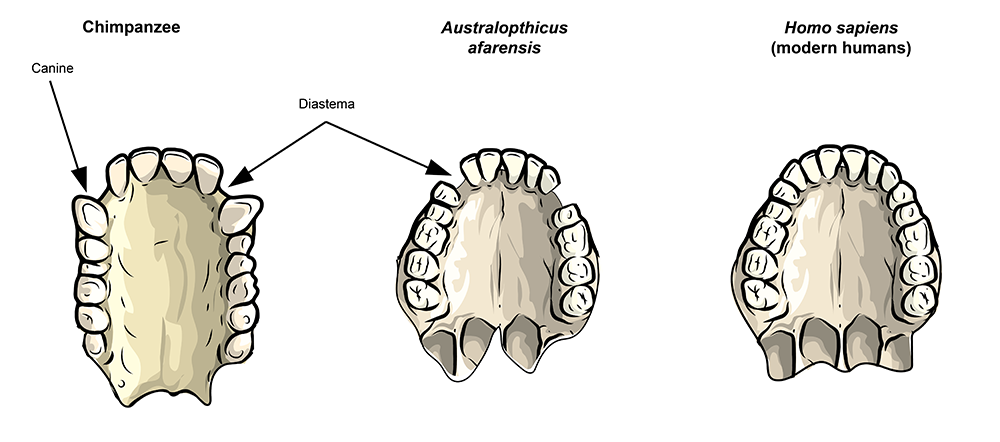 Dental Arc Comparision