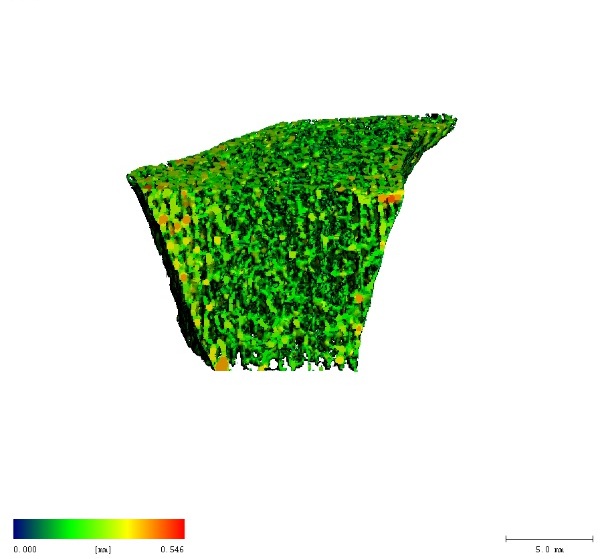Trabecular density