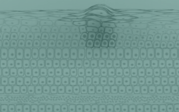Image analysis