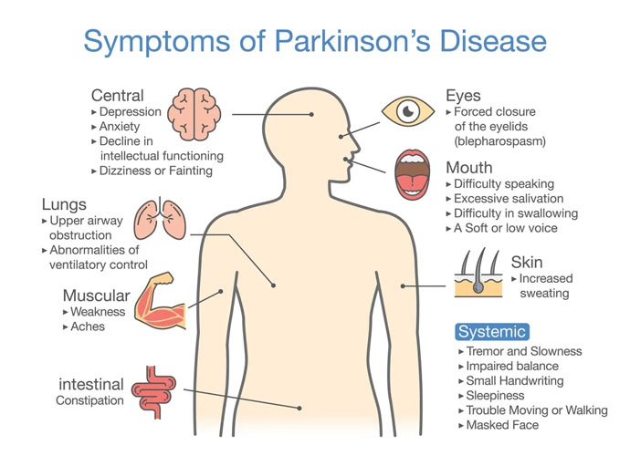 Symptoms of Parkinson's Disease