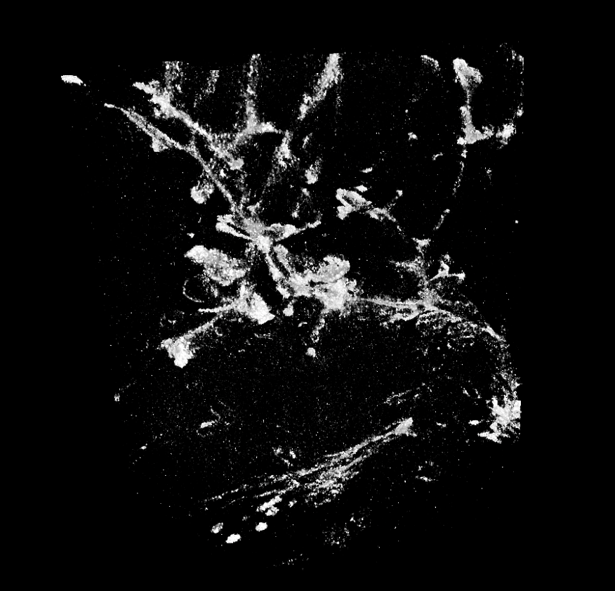 X-Ray