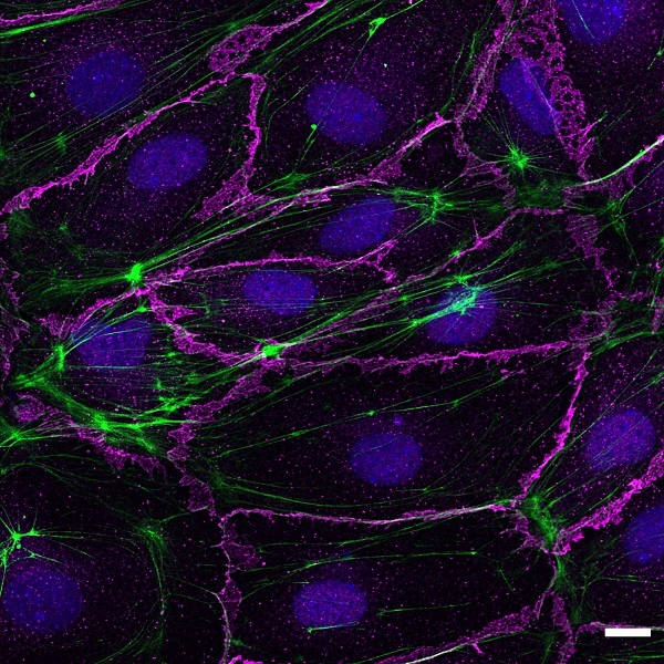TRPV4 activation affects junctional morphology in lymphatic endothelial cell monolayer. Stained for actin (green), VE-cadherin (Magenta) and nuclei (blue)