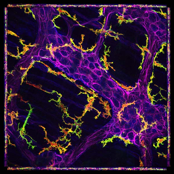 This is an image of the outermost wall of the mouse colon. 
