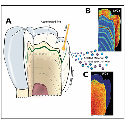 Schematic diagram of the use of laser ablation analysis to map the concentration of strontium and uranium within a tooth. Renaud Joannes-Boyau, SCU. Schematic diagram of the use of laser ablation analysis to map the concentration of strontium and uranium within a tooth. Renaud Joannes-Boyau, SCU.