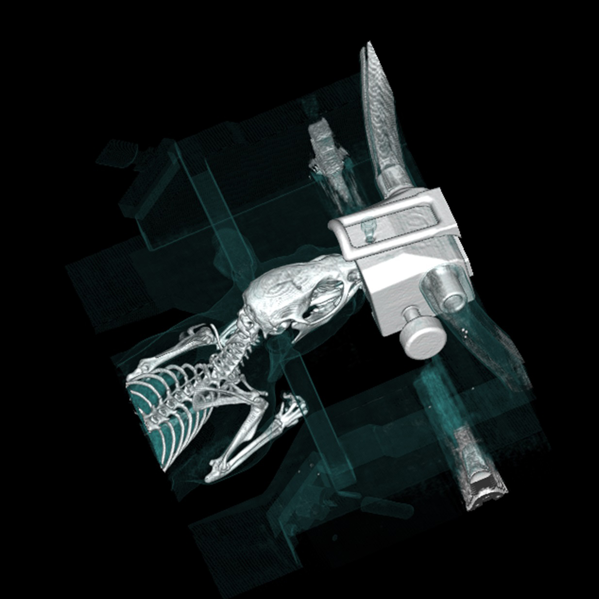 CT image