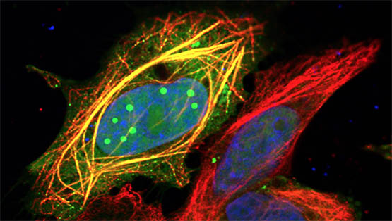 Confocal microscopy image of human cells showing a rabies virus P3-protein (green) forming liquid-like droplets inside the nucleus (blue), localising to nucleoli, and binding to and bundling the cell’s structural framework called microtubules (red). Image credit: Dr Stephen Rawlinson, Monash University.