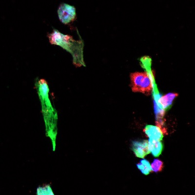 Neutrophil Extracellular Trap