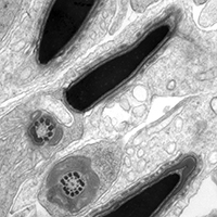 Electron micrograph of developing spermatids in the mouse testis. Image: Jo Merriner (O'Bryan Lab) and Martin Bergmann. Electron micrograph of developing spermatids in the mouse testis. Image: Jo Merriner (O'Bryan Lab) and Martin Bergmann.