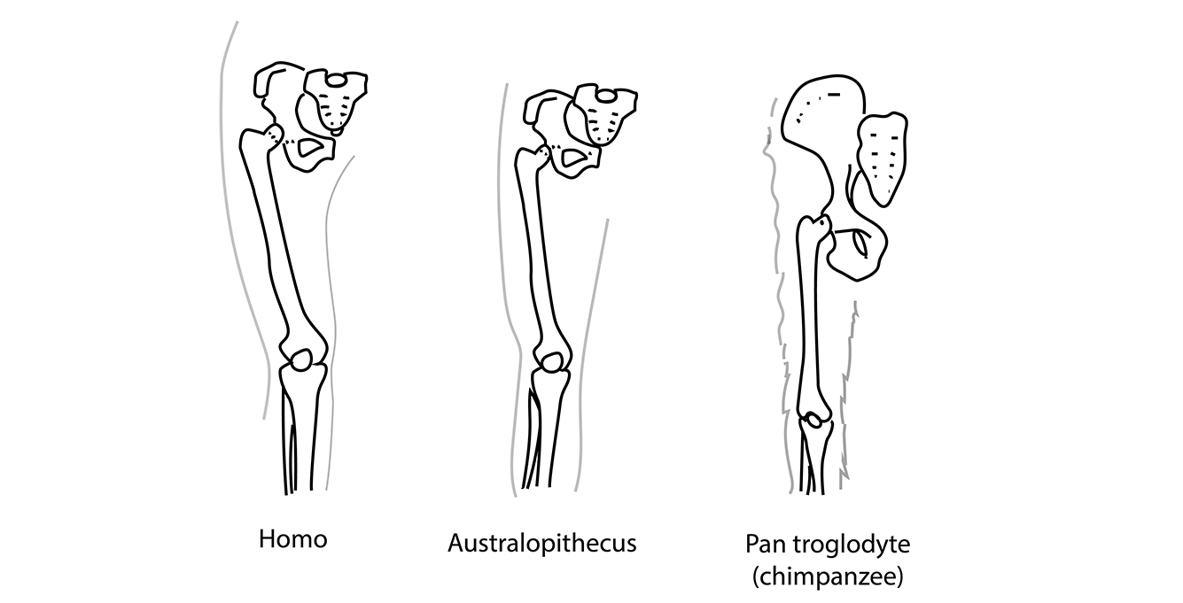 Bicondylar Angle human