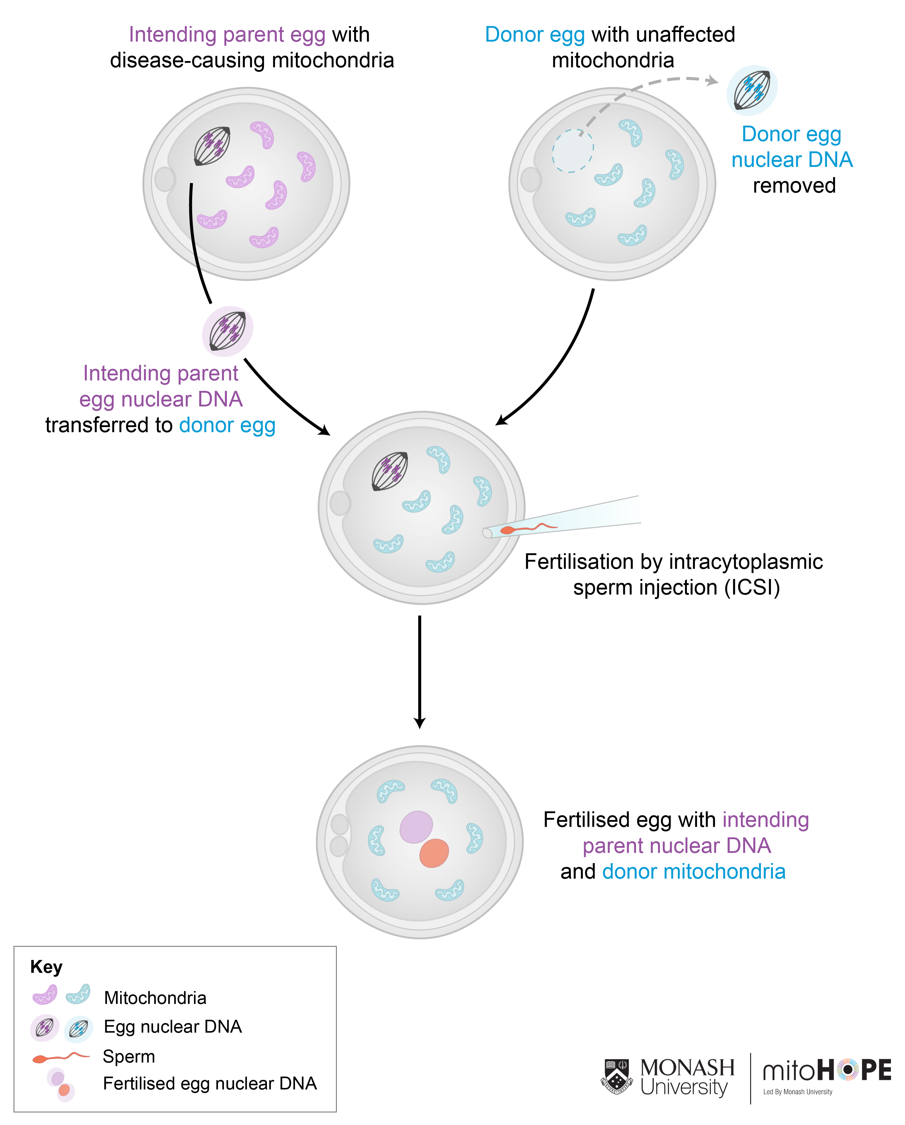Maternal Spindle Transfer