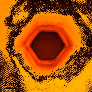 Electron micrograph