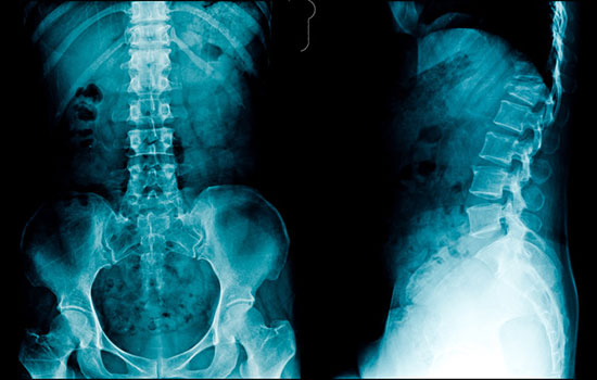 Why we're wasting money on medical tests