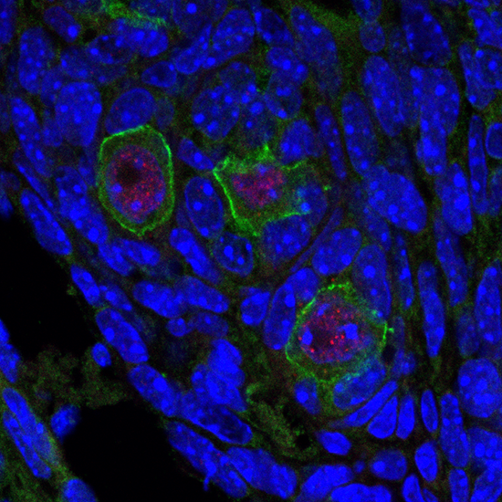 Ovarian tissue containing fluorescently-labelled oocytes (eggs; green) with a BRCA1 mutation, showing sites of DNA damage (red).