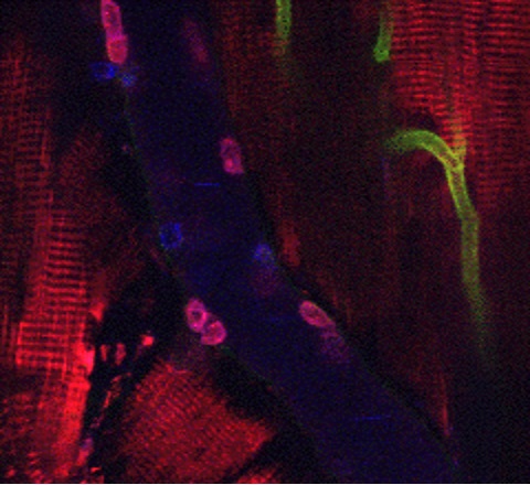 Leukocyte recruitment