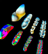 Dental Complexity. Image: A/Professor Alistair Evans. Dental Complexity. Image: A/Professor Alistair Evans.