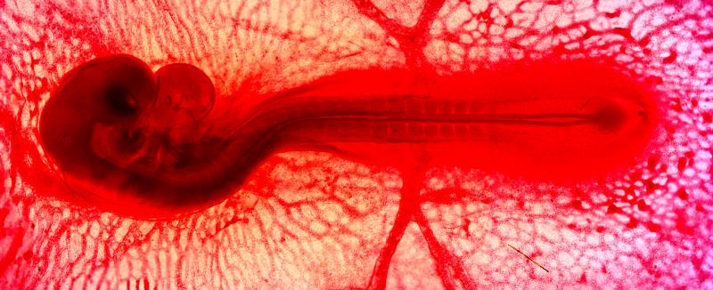 Chicken Embryo - Whole Mount 