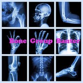 Bone Banter
