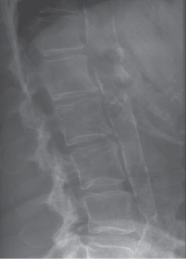DXA4